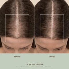 VEGAMOUR GRO+ polyphenol plant actives emphasize antioxidant protection for scalp
