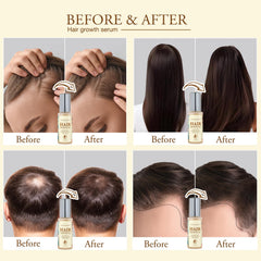 Venanoci dropper ready for easy daily application on the scalp.