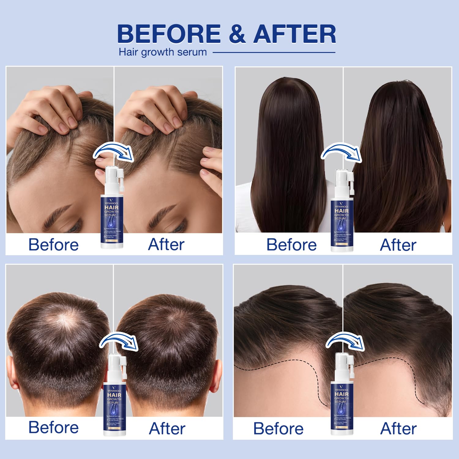Venanoci Hair Growth Spray applying to the scalp for absorption