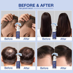 Venanoci Hair Growth Spray applying to the scalp for absorption