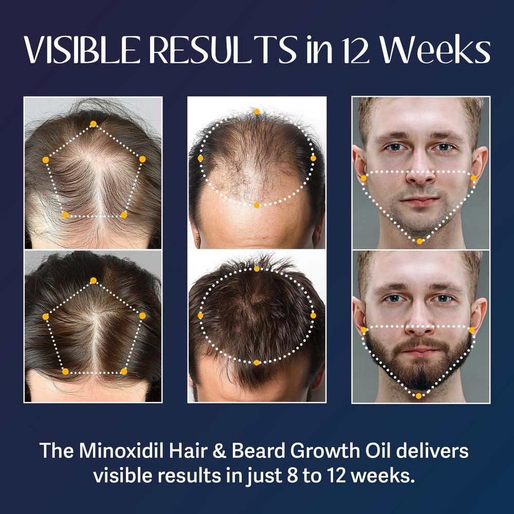 Venanoci rosemary hair growth serum tube showcases a refreshing, lightweight daily care