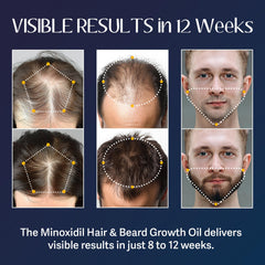 Venanoci rosemary hair growth serum tube showcases a refreshing, lightweight daily care