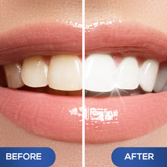 Venus Visage teeth whitening pen gel drop demonstrates fast-drying formula