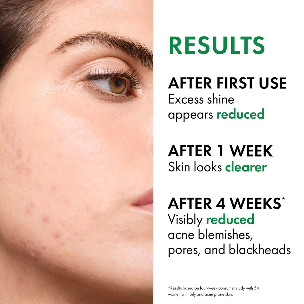 VICHY Normaderm foam-closeup emphasizes light foam and non-drying finish.