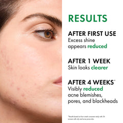 VICHY Normaderm foam-closeup emphasizes light foam and non-drying finish.