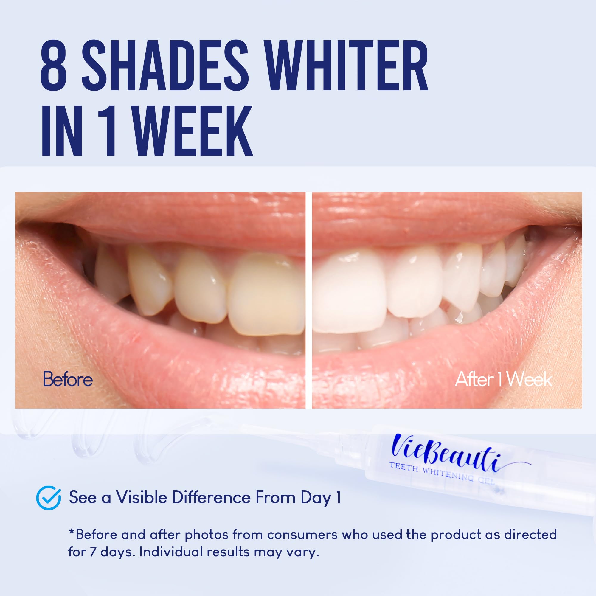 VieBeauti whitening gel pens for even application and gentle results