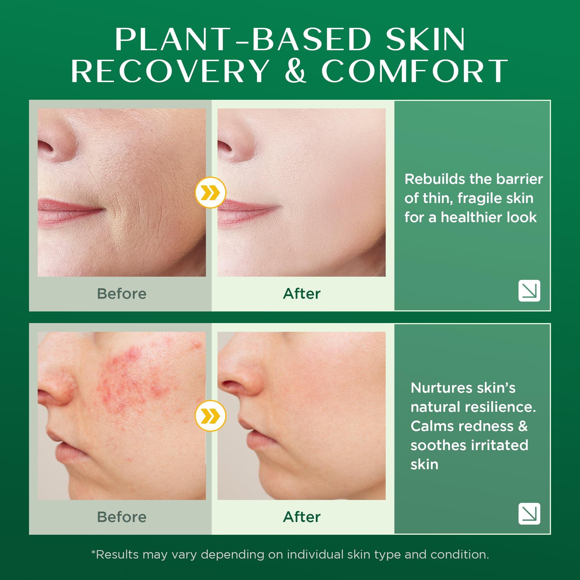 Skin barrier support visual indicating resilience for delicate areas