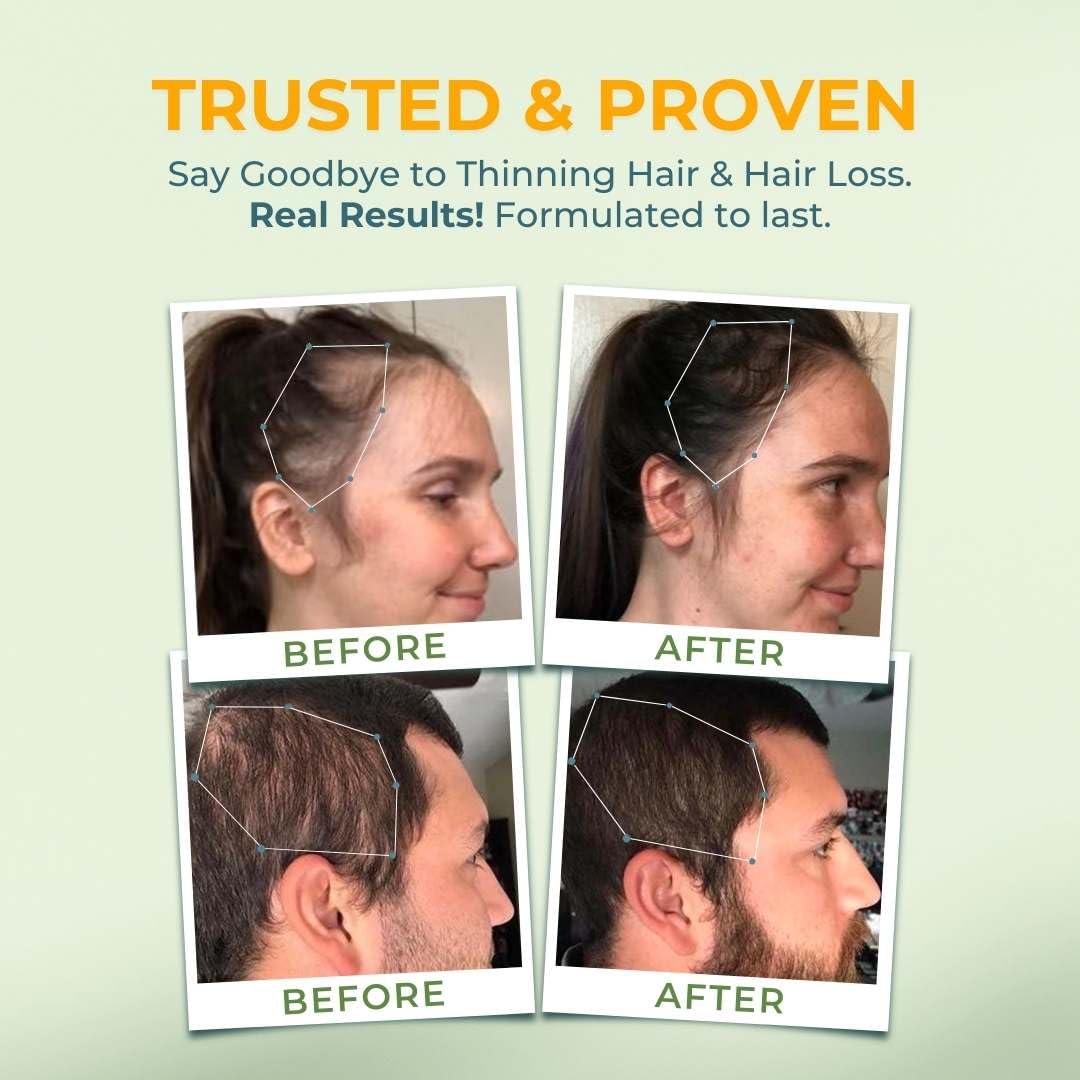 Vital Hair Complex gluten-free formulation on packaging