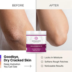 Vitality Helichrysum Balm ingredient scene with olive and almond oils