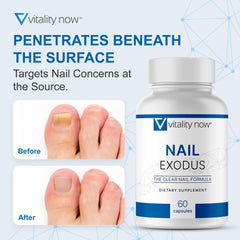 Vitality Now Nail Exodus bottle open reveals accessible capsules