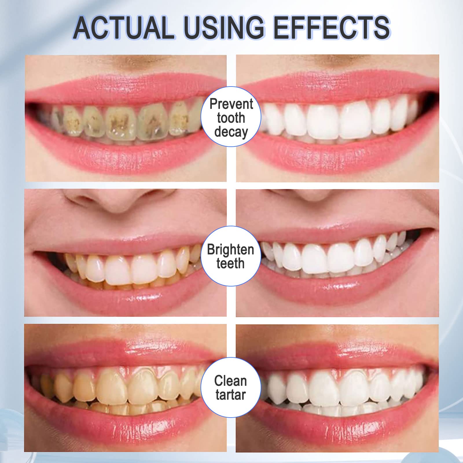 VOGSIG foam reaching the gum line for gentle cleansing.
