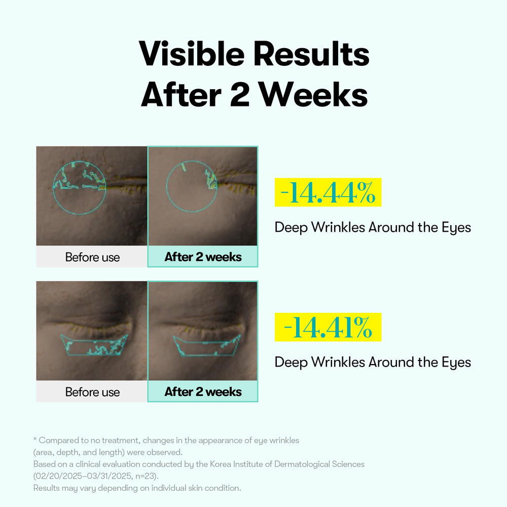 VT COSMETICS PDRN Reedle Shot micro-vibration device enables consistent, gentle eye-area treatment.