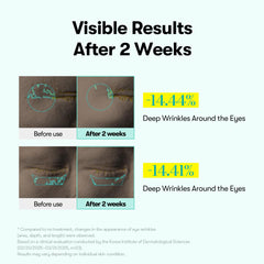 VT COSMETICS PDRN Reedle Shot micro-vibration device enables consistent, gentle eye-area treatment.
