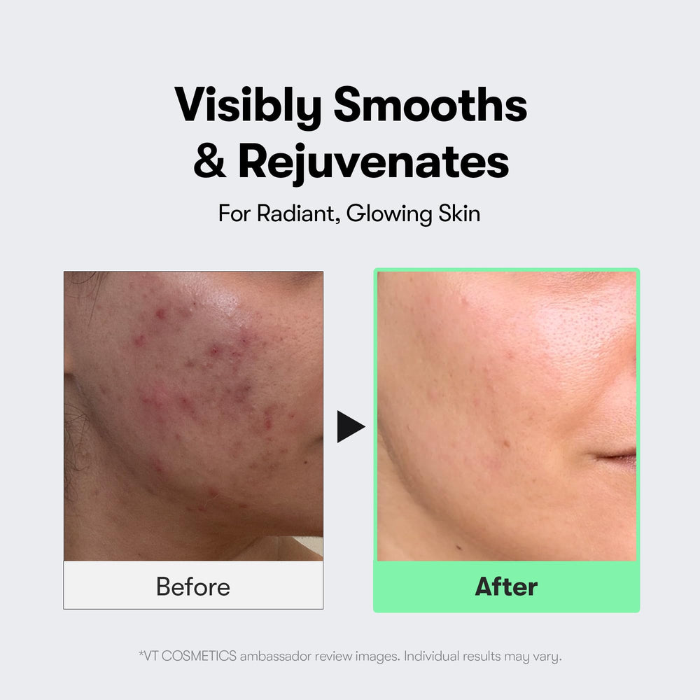 VT COSMETICS Reedle Shot micro-needling detail suggests enhanced absorption.
