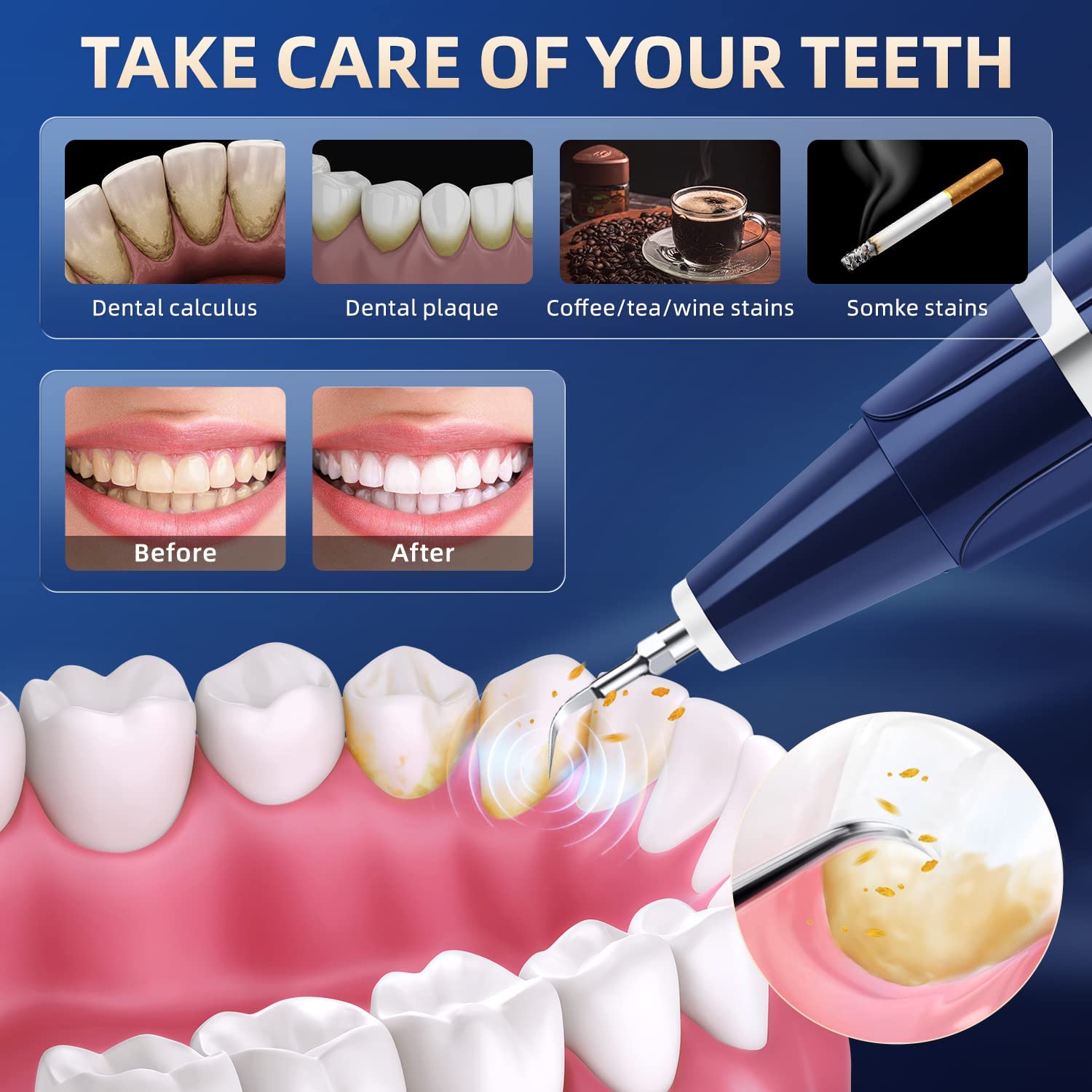 Vtiisamao dental calculus remover LED light for better visibility while cleaning