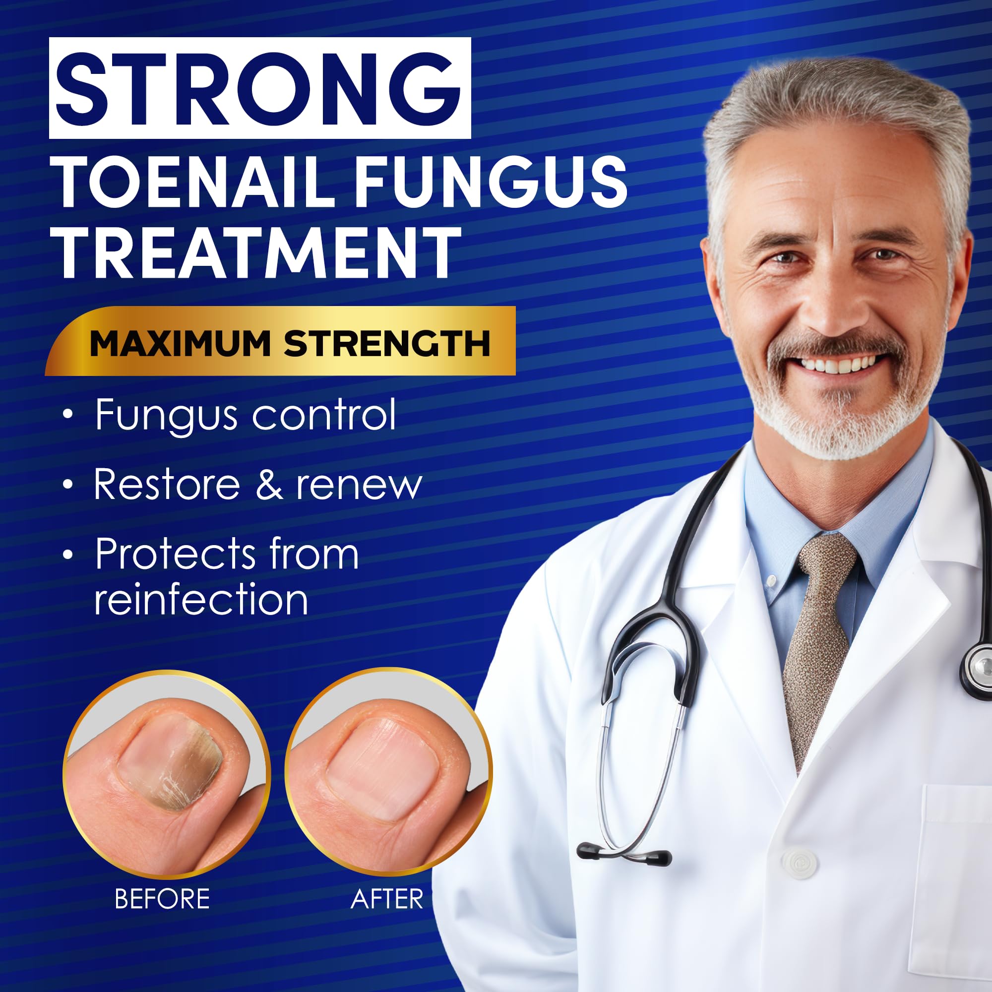 VTROUY advanced nail and toe repair solution deeply penetrates for stronger nails.