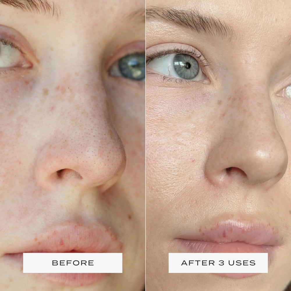 Vue Nose Patches mattify the nose and refine visible pores.