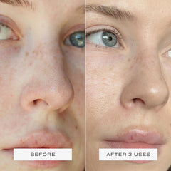 Vue Nose Patches mattify the nose and refine visible pores.