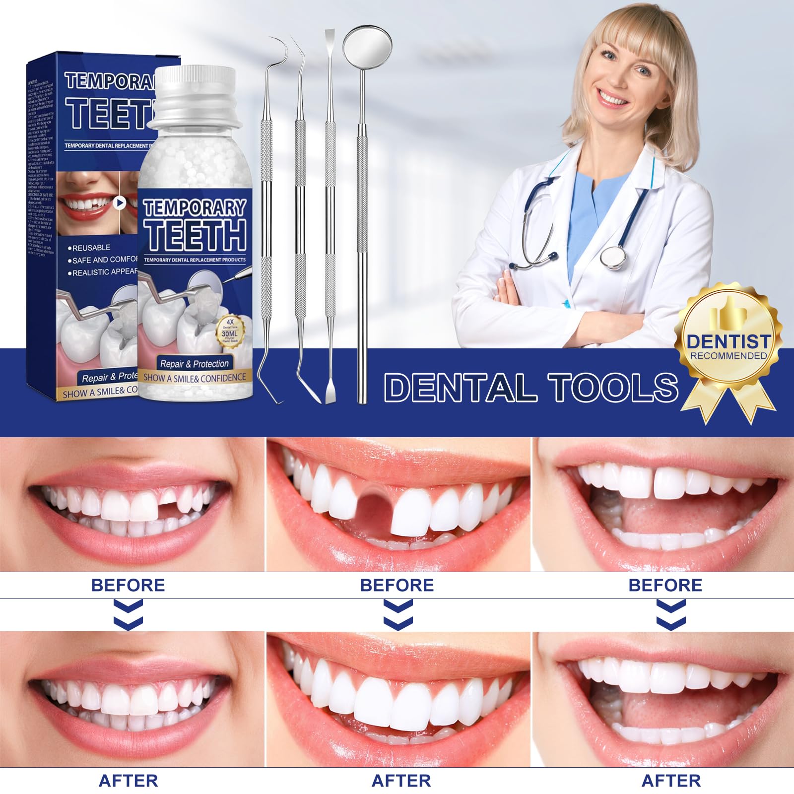 Smile enhancement with WALEJUC temporary tooth after placement.