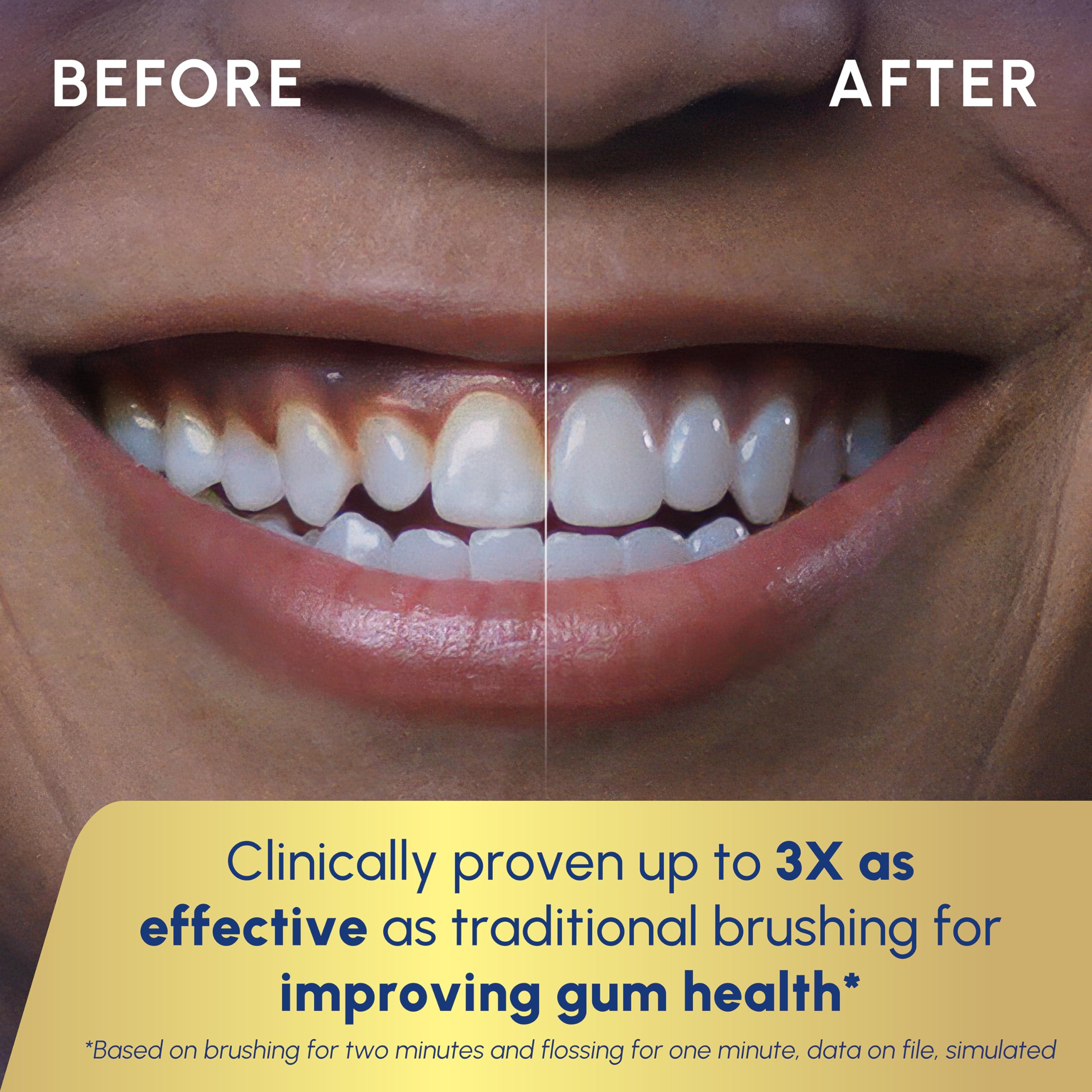 Waterpik flosser tips rotate 360 degrees for thorough reach between teeth.