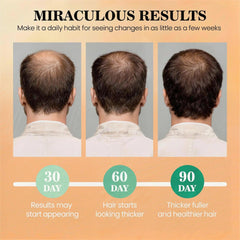 WEEMOTD Batana oil on scalp during quick nourishing routine.