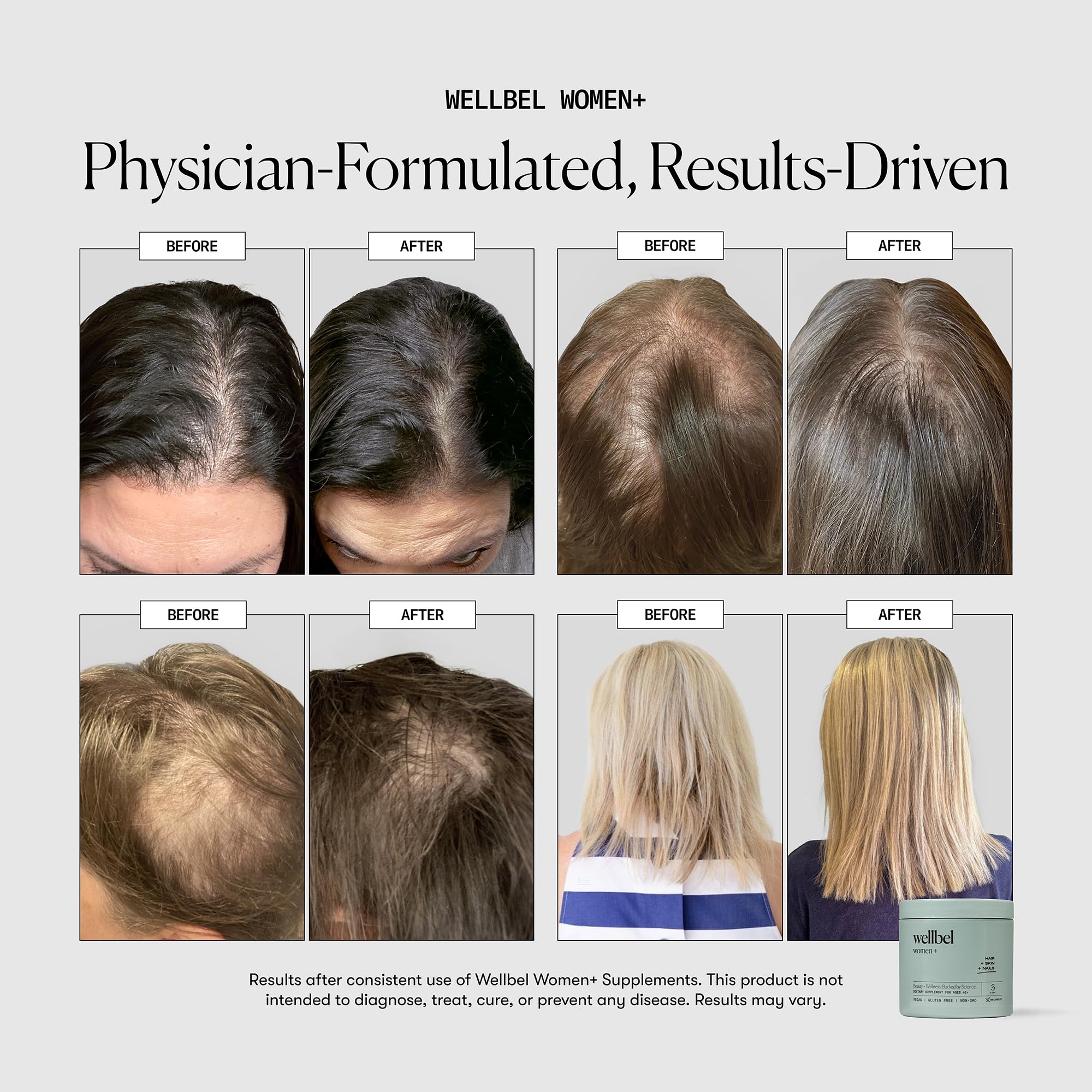 WELLBEL Women+ capsules closeup showing daily wellness support for hair and nails