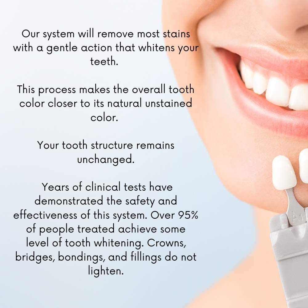 White Teeth Global careful gel application tips to minimize irritation.