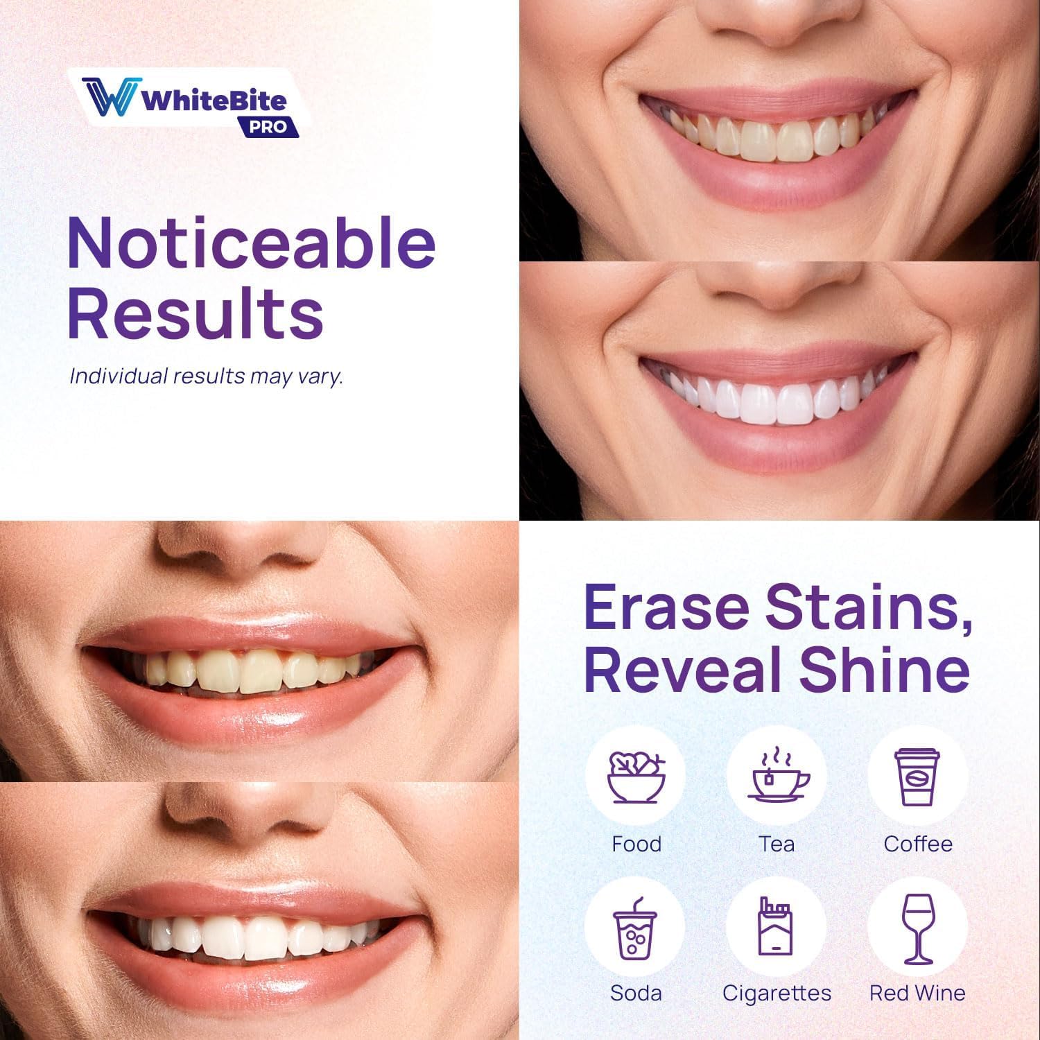 Whitebite Pro two-week supply of 28 strips supports daily use