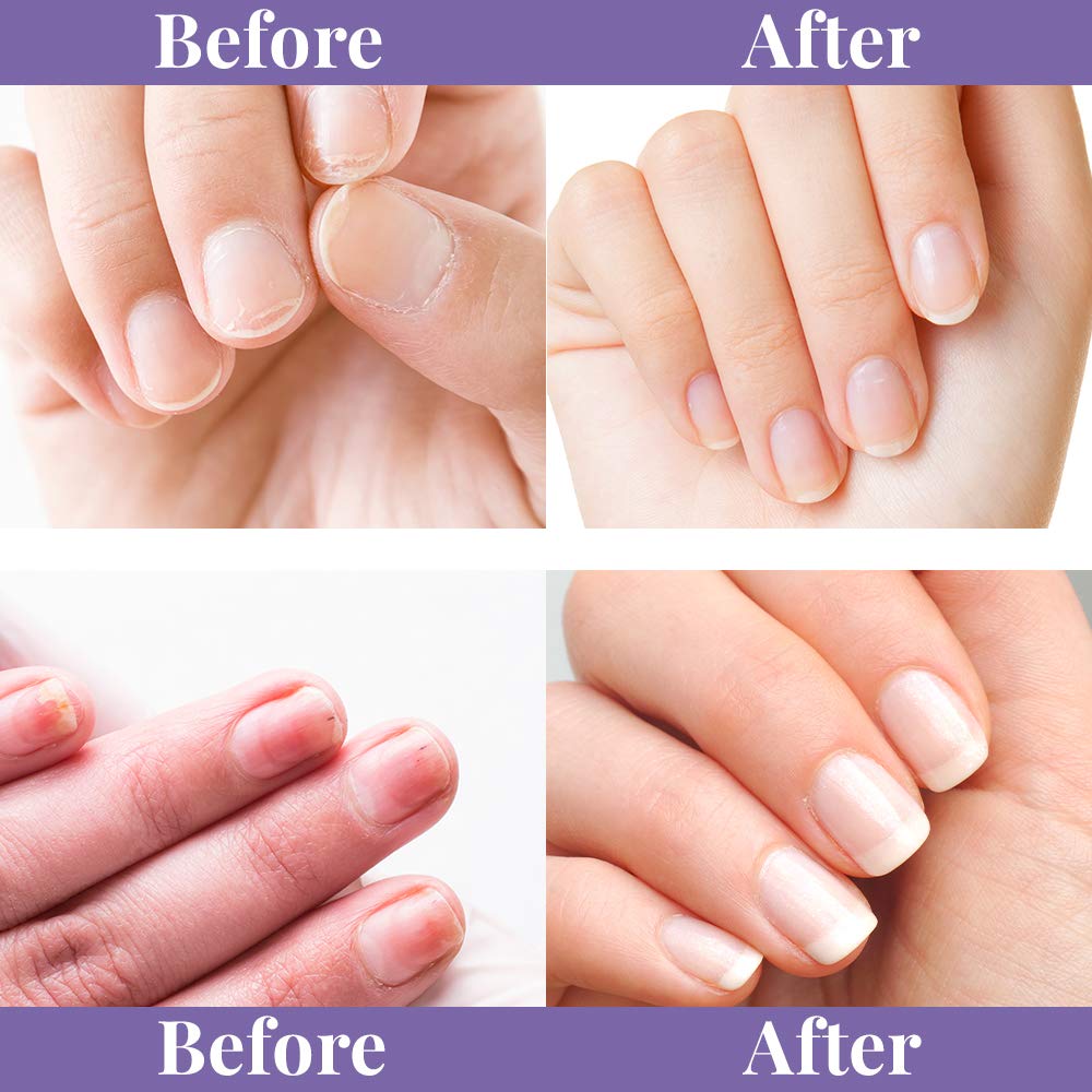 Nail bed circulation stimulation from gentle buffing action