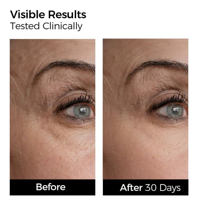 WNP Prickle Cell Layer capsule signaling collagen support.