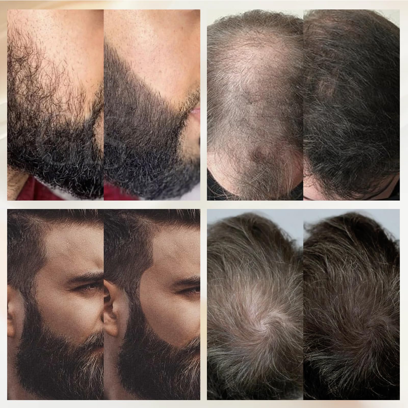 WOZUTUNT full-beard-contour defines shape and symmetry