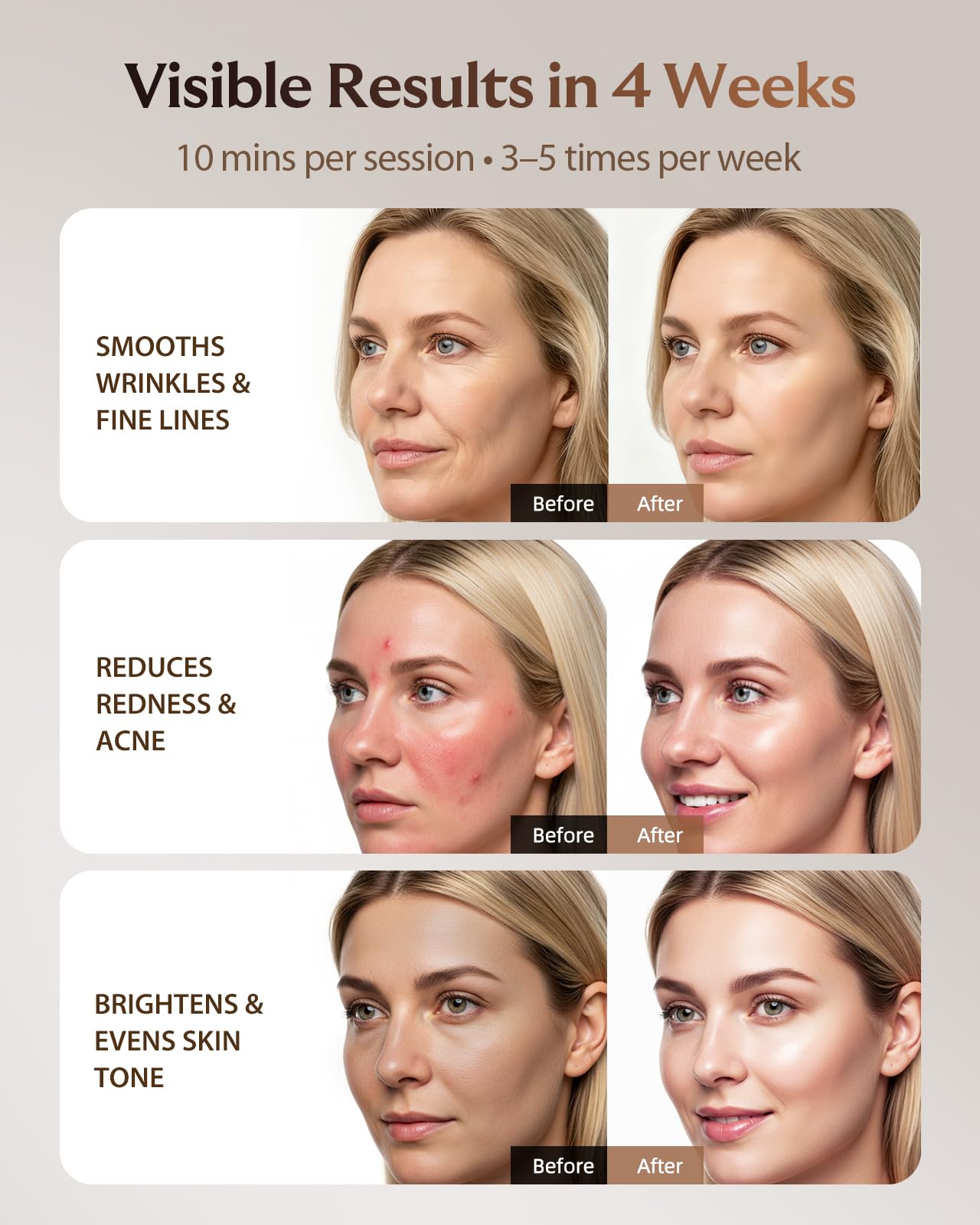 XSSNVV amber light treatment softens redness appearance for gentle radiance
