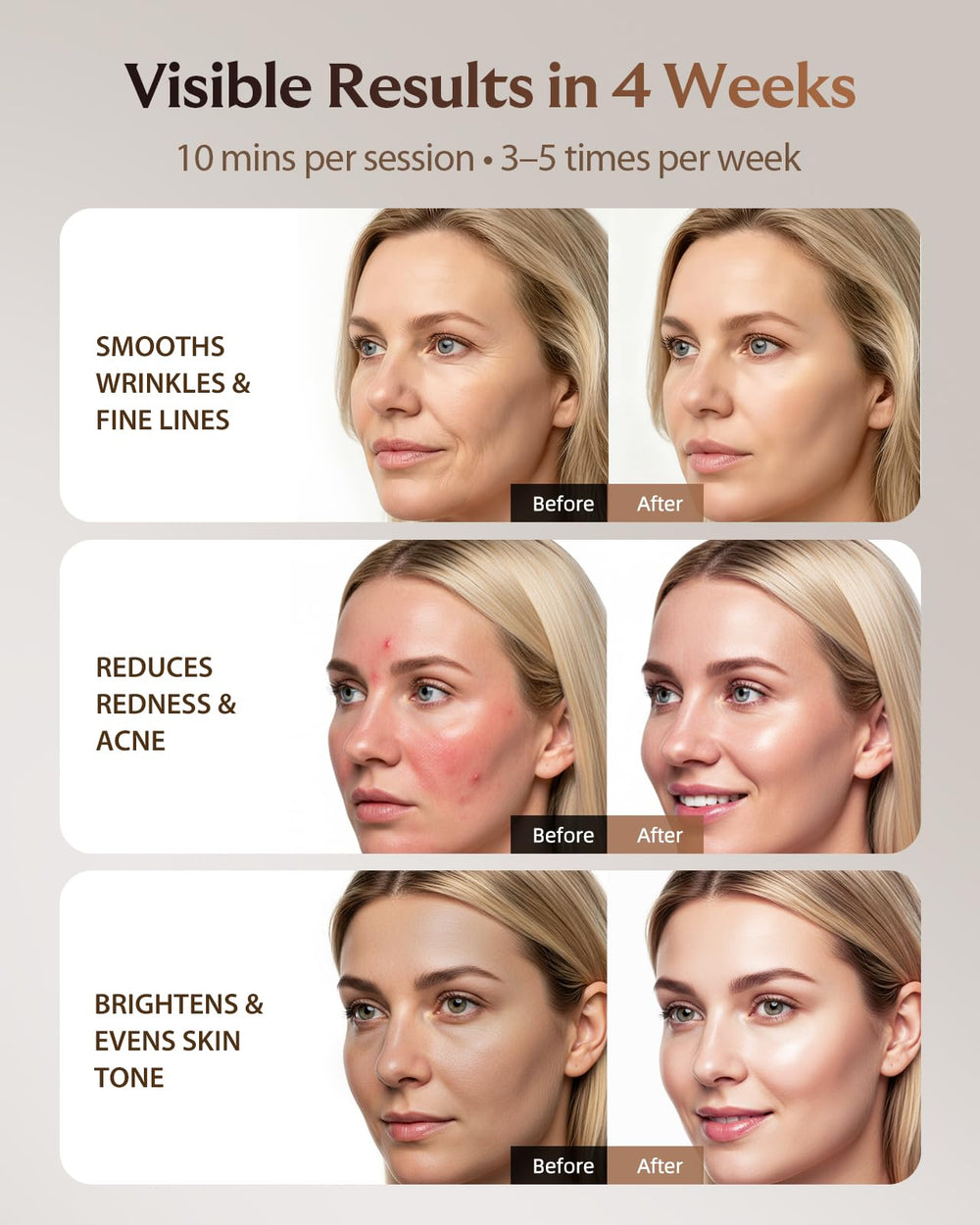 XSSNVV amber light treatment softens redness appearance for gentle radiance