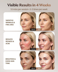XSSNVV amber light treatment softens redness appearance for gentle radiance