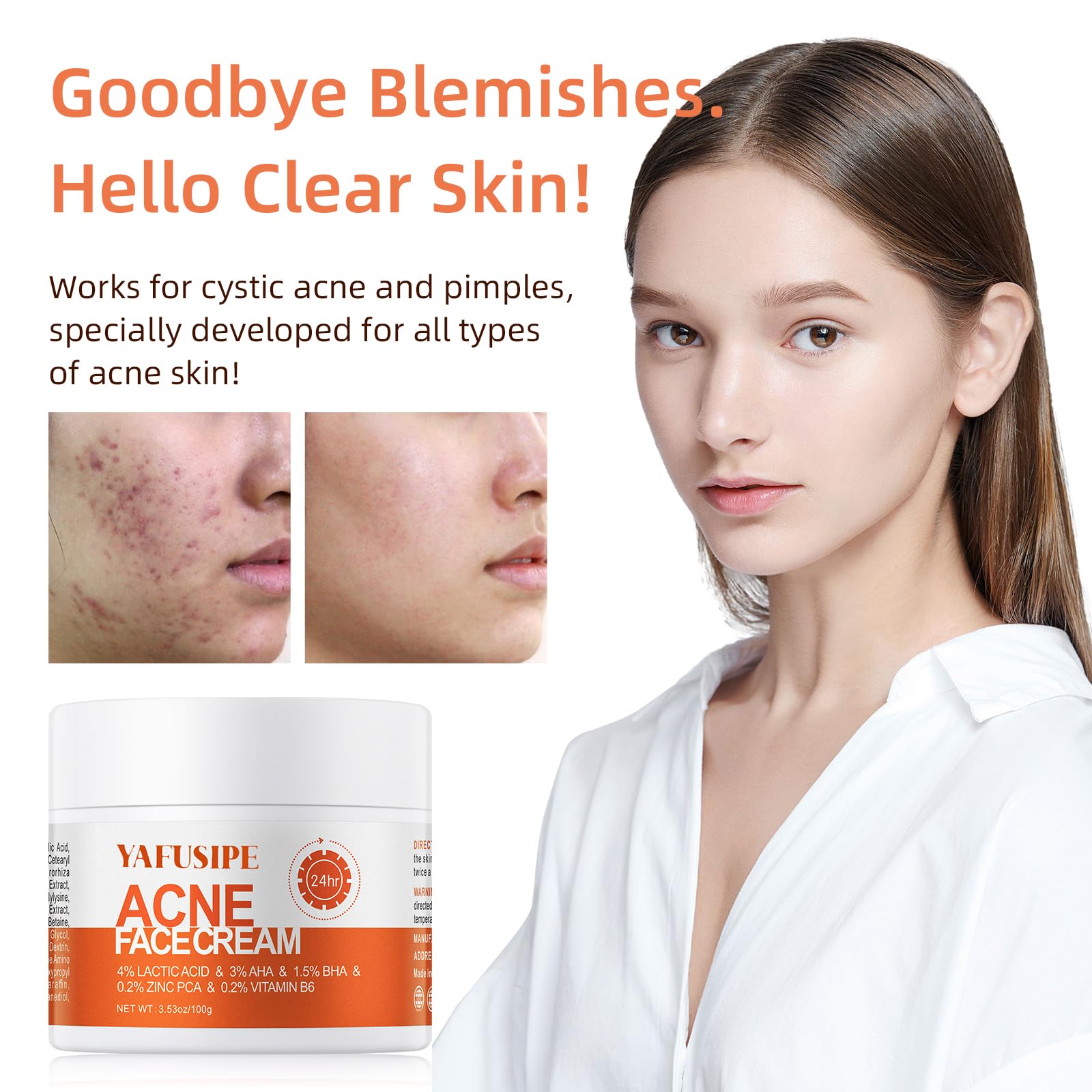 YAFUSIPE acne treatment cream close-up displaying smooth, moisturized texture.