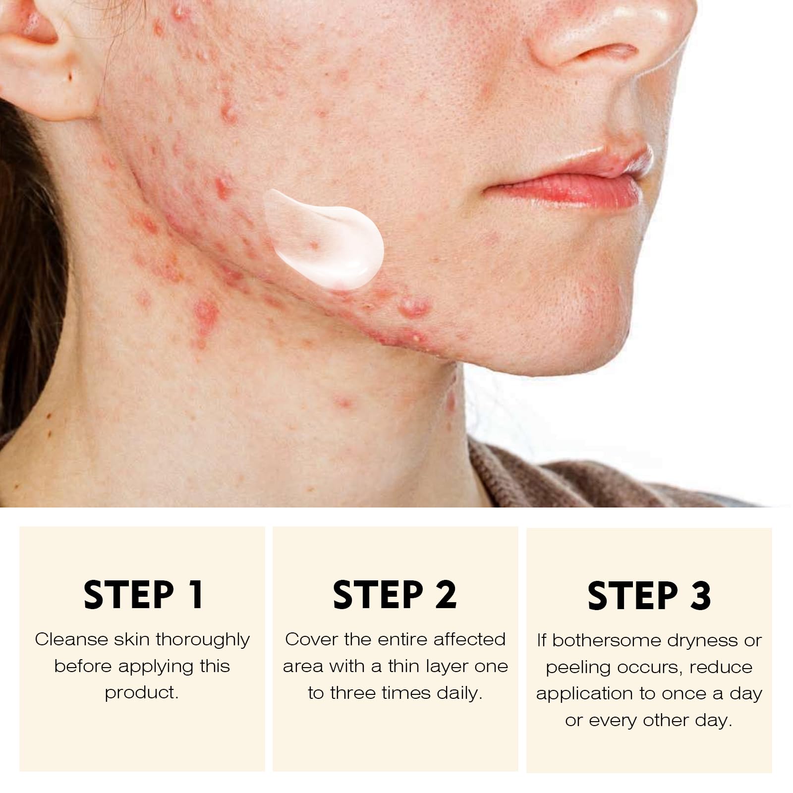 YAFUSIPE packaging shown for easy, routine spot care.