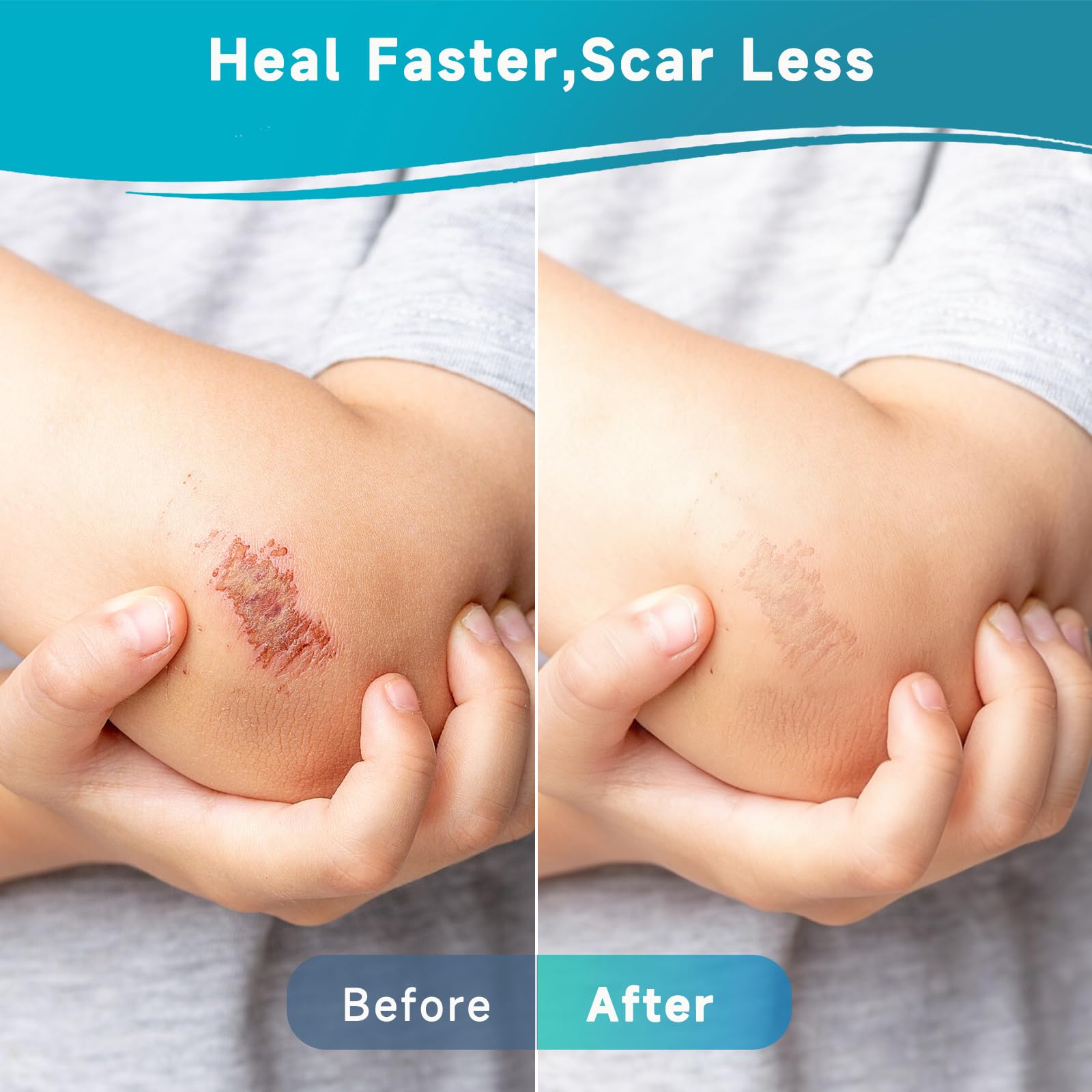 Yarster hydrocolloid roll sits in a ready-to-go first aid kit.