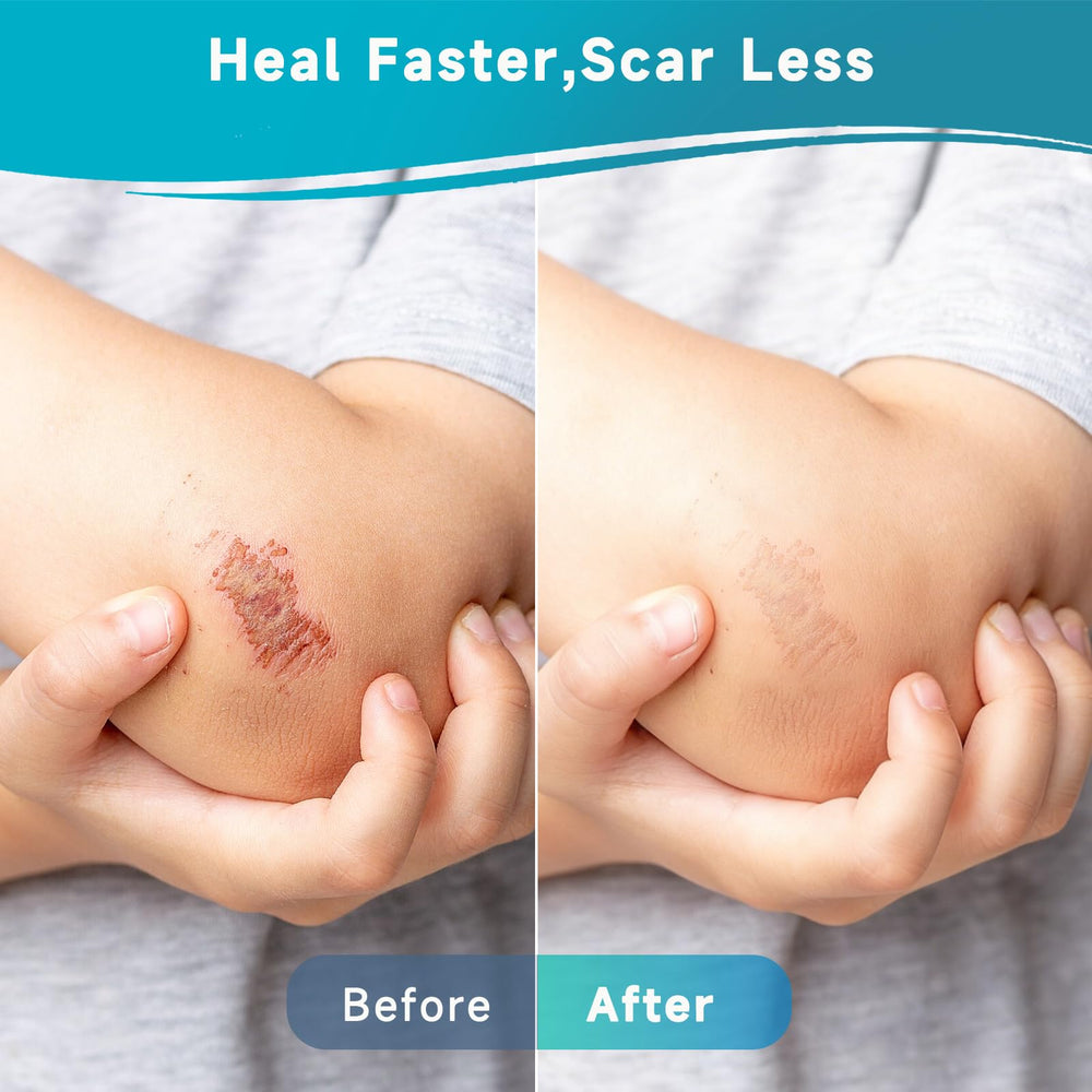 Yarster hydrocolloid roll sits in a ready-to-go first aid kit.