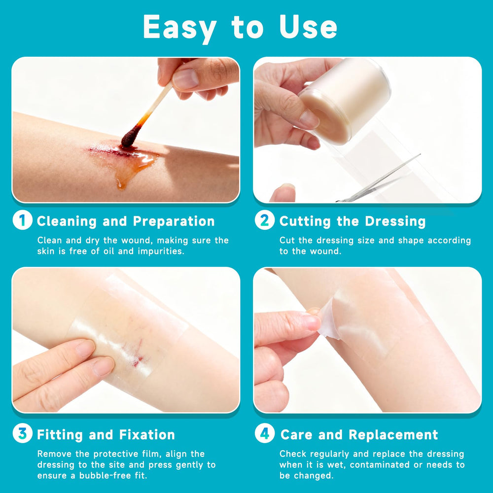 Yarster hydrocolloid roll semi-transparent film allows monitoring.