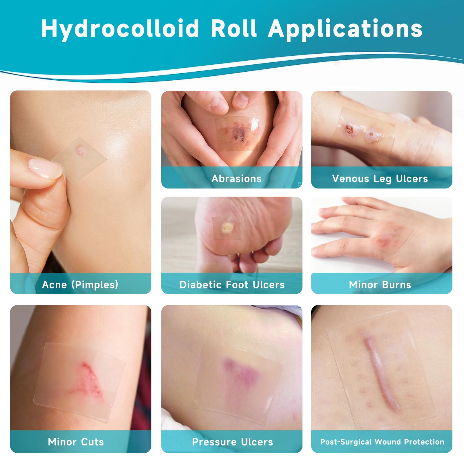 Yarster hydrocolloid roll ultra-absorbent layer helps manage moisture.