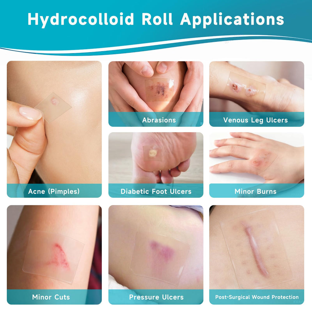Yarster hydrocolloid roll ultra-absorbent layer helps manage moisture.