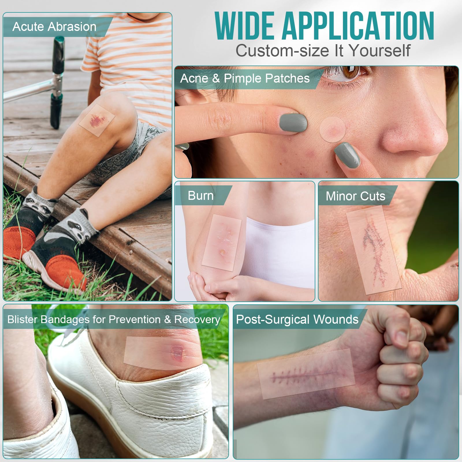 YHOVID bed sore prevention bandage providing gentle protection