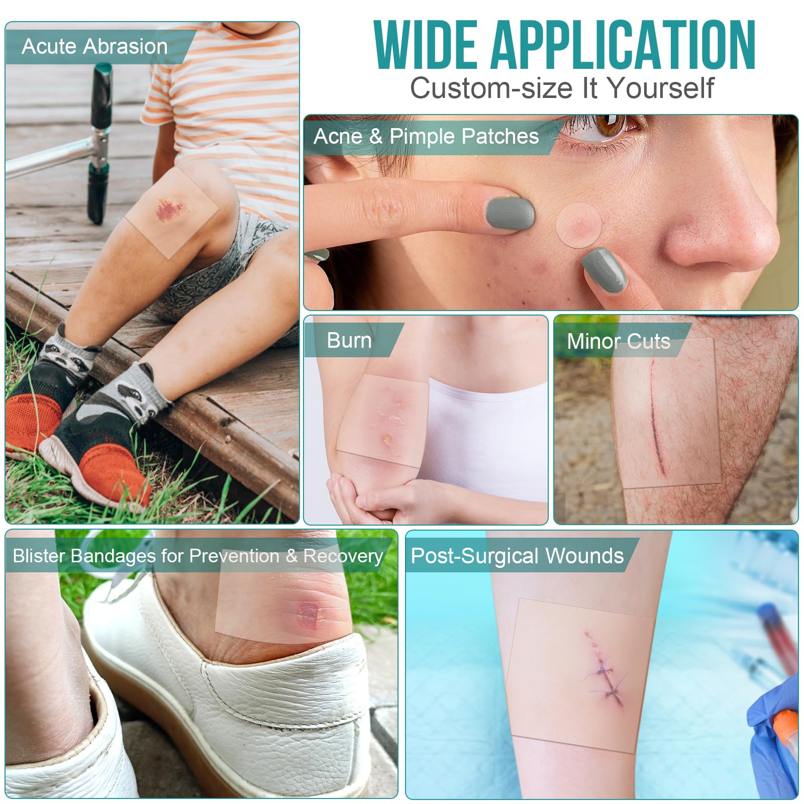 YHOVID hydrocolloid dressing shown on elbow or knee with flexible adhesion.