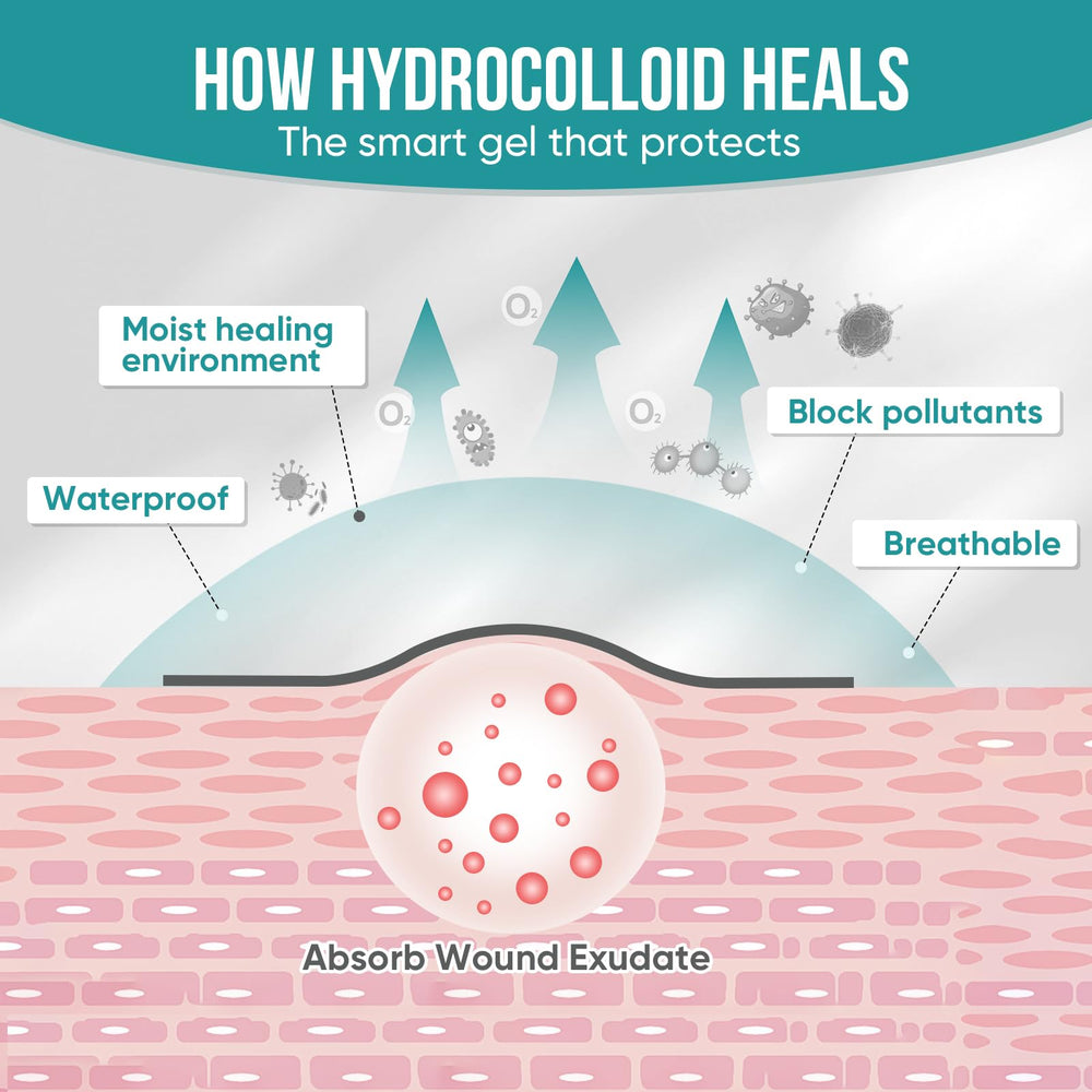 YHOVID hypoallergenic hydrocolloid material suitable for sensitive skin