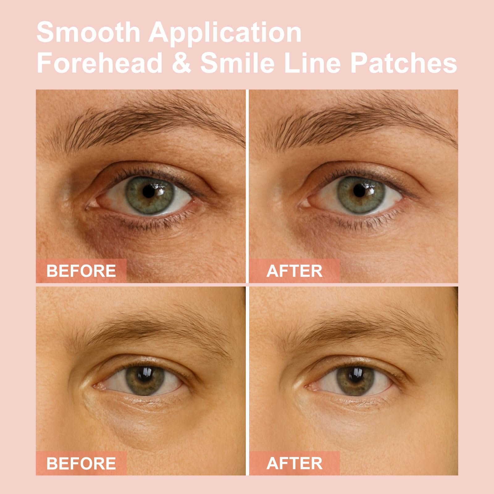 YLOTRE Novalift contoured patches fit securely under the eyes