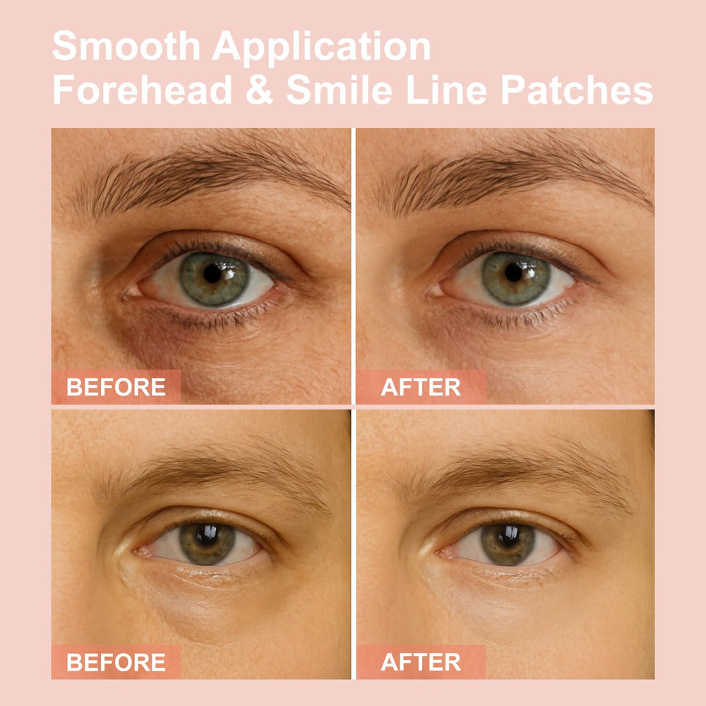 YLOTRE Novalift contoured patches fit securely under the eyes