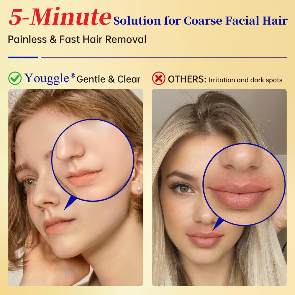 Youggle upper lip treatment delivers precise, painless hair removal for delicate areas.