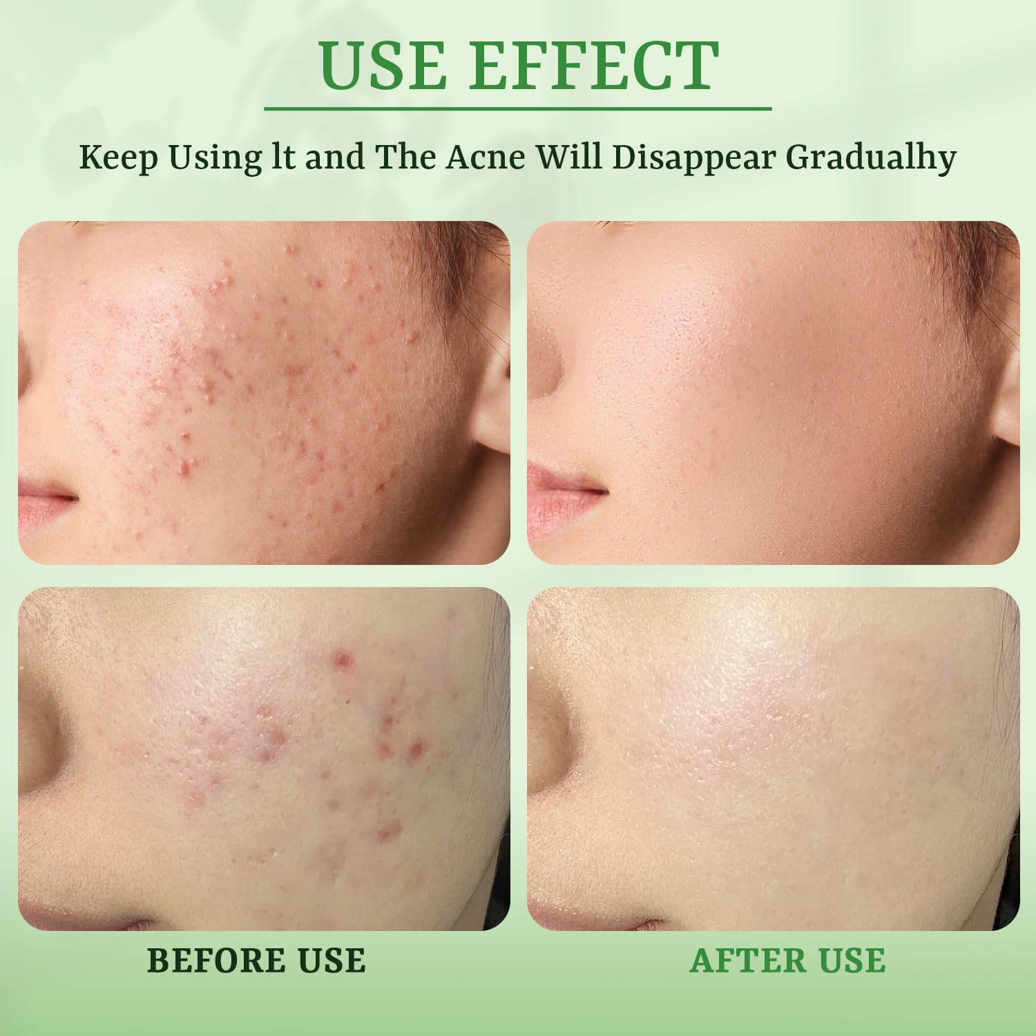 YTRAJU niacinamide brighten and even tone for a fresher complexion