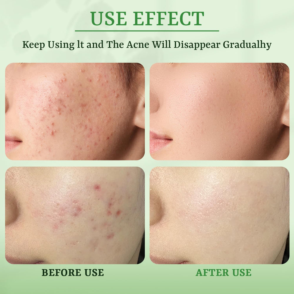 YTRAJU niacinamide brighten and even tone for a fresher complexion