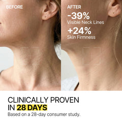 Z:SEA decolletage skin close-up reveals crepey texture and smoothness potential.